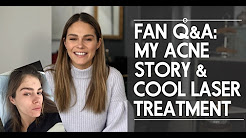 Fan Q&A: My Acne Story & My Cool Laser Treatment