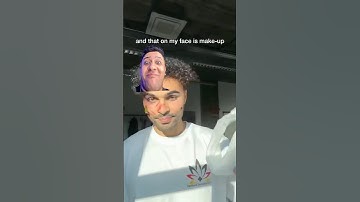 So To Answer Your Questions ⁉️ It Didn’t Hurt 💀 But Please Don’t Try It At Home 🏠. 🤩 #shorts