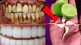 Teeth Whitening And Scaling at Home || How to Whiten Your Yellow Teeth Naturally at Home ?