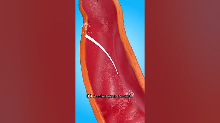 What Happens If You Swallow a Large Fish Bone #short - Creativelearning3d