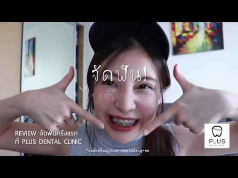 จัดฟันครั้งแรก ทำอะไรบ้าง? น้องบีบี ที่ Plus Dental Clinic