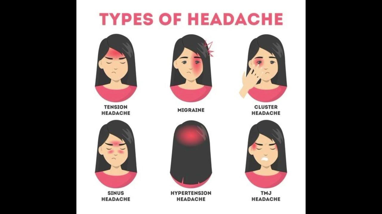 Где болит при мигрени. Боль при мигрени. Головная боль при мигрени. Отличие мигрени от головной боли. Виды головной боли мигрень.