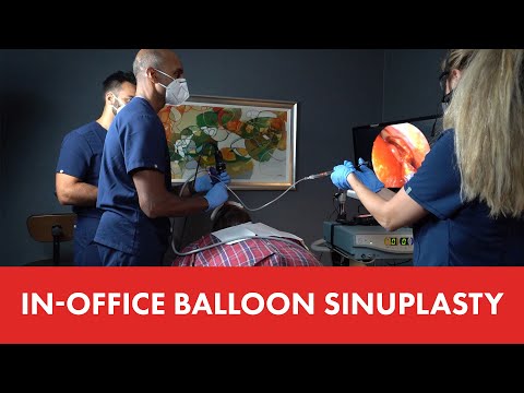 Erik's In-office Balloon Sinuplasty and Turbinate Reduction