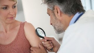 Fakty I Mity Na Temat Usuwania Znamion