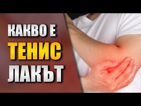 Облекчаване на болка в лактите - Тенис лакът