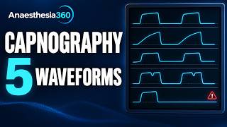 Capnography Explained: 5 Waveforms Every Anaesthesia Resident Should Know