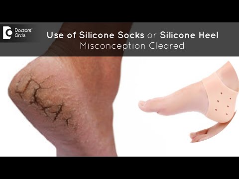 Use of silicone socks or silicone heel for treating cracked heels -  Dr.Nischal K C | Doctors' Circle - YouTube