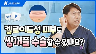 켈로이드성 피부도 쌍커풀 수술할 수 있나요??🥐[MINA쌍커풀Q&amp;A]