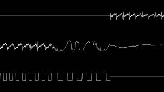 Sonic 2 (Beta) - Metropolis/Wood Zone (oscilloscope view)