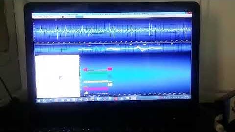 Single Unit recording (spike)