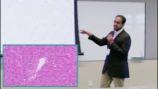 Pathology: AIH Under the Microscope