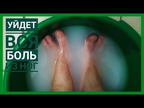 Видео: Эндометриозная боль в ногах: идентификация, лечение и многое другое