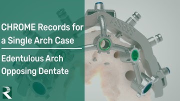 CHROME Records for single arch case: Edentulous surgical arch, with opposing Dentate
