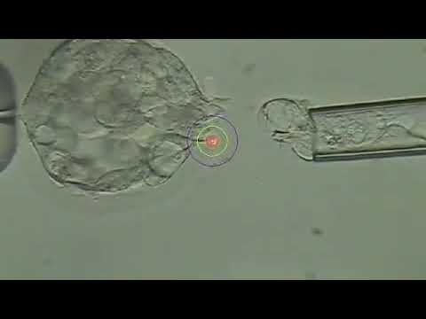 Day 5 Trophectoderm Biopsy by Goral Gandhi - YouTube