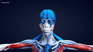 Tech Tuesday: New technology helping stroke patients