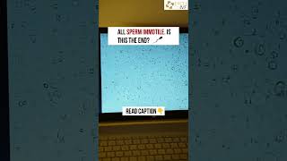 NO Sperm Motility? IVF Success Possible with ICSI | Non-Motile Sperm Explained | Dr Rhythm Gupta