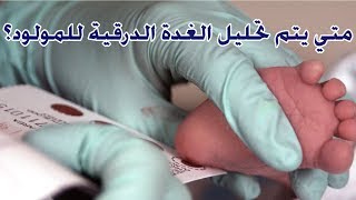 متي يتم عمل تحليل الغدة الدرقية للمولود؟