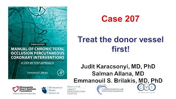 Case 207: Manual of CTO PCI - Treat the donor vessel first!