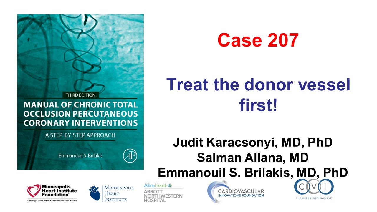 Case 207: Manual of CTO PCI - Treat the donor vessel first! - YouTube