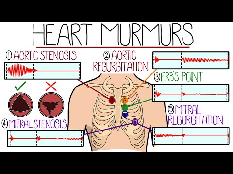 Learn Heart Murmurs In 10 Minutes (With Heart Murmur Sounds)
