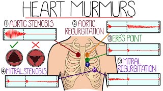 Learn Heart Murmurs In 10 Minutes (With Heart Murmur Sounds) by Rhesus Medicine 169,265 views 7 months ago 10 minutes, 58 seconds