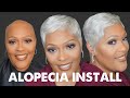 White Short Hair on My Alopecia Lace Install/Make a large wig small #shorthaircut #boldhold