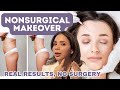 Nonsurgical Makeover✨Dermatologist-Approved Treatments Without Surgery
