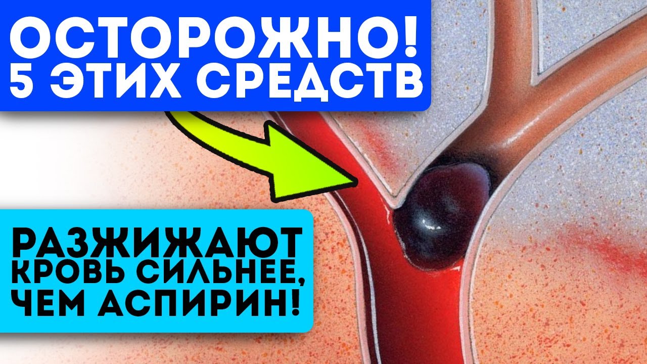 Подсмотрела дома у знакомого кардиолога! Великолепное средство для ...