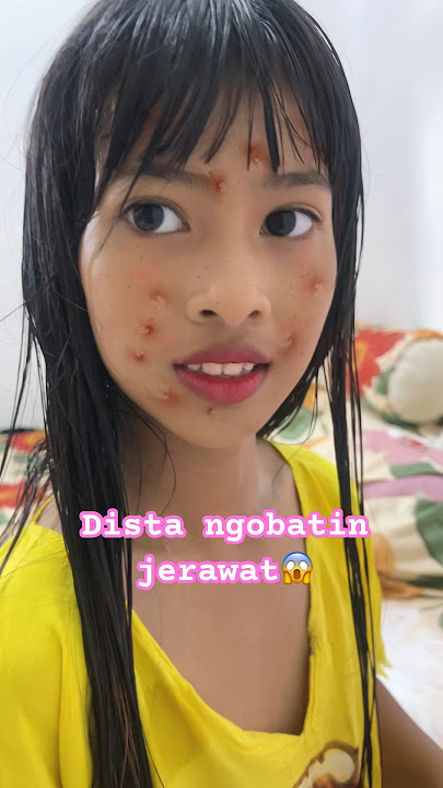 PANIK DISTA BANYAK JERAWAT😭😭#trending #viralvideo #shortviral