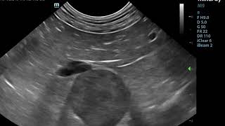 Left adrenal mass - ultrasound in a dog
