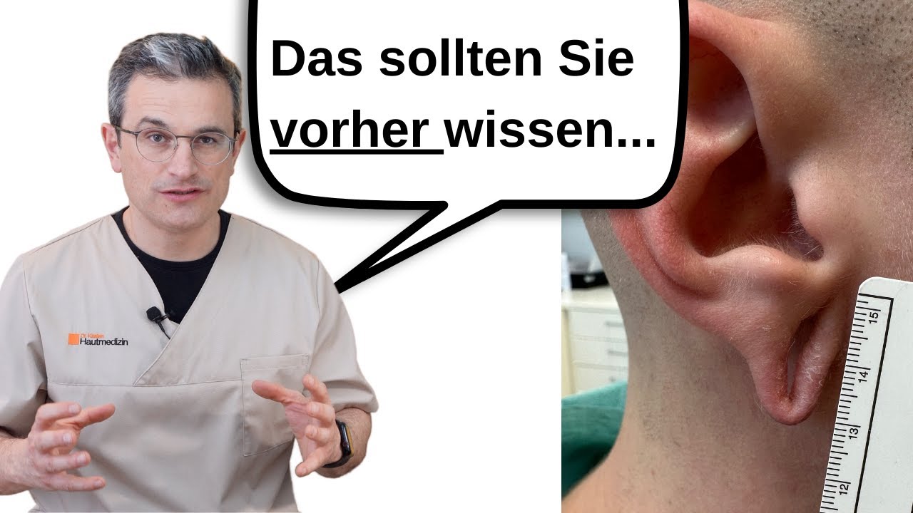 Wie Wird Ein Tunnel Im Ohr Gemacht Ohrtunnel verschliessen (zunähen). Alle wichtigen Informationen in