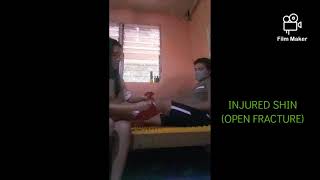 First Aid NSTP 2(midterm exam)