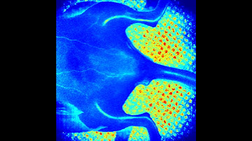 Laser Speckle Contrast Imager System - Pseudo color - Limb 2