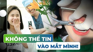 Lại thêm Hotgirl nữa được Tháo mắc cài Niềng răng