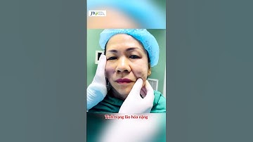 Bác sĩ Tú Dung Căng da mặt Mesh Lift U60 trẻ lại 20 TUỔI