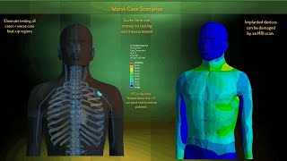 Enabling Medical Device Innovation through Simulation