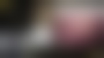 Laparoscopic component separation