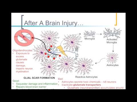 मस्तिष्क की चोट और रोग में ग्लियाल सेल की भूमिका