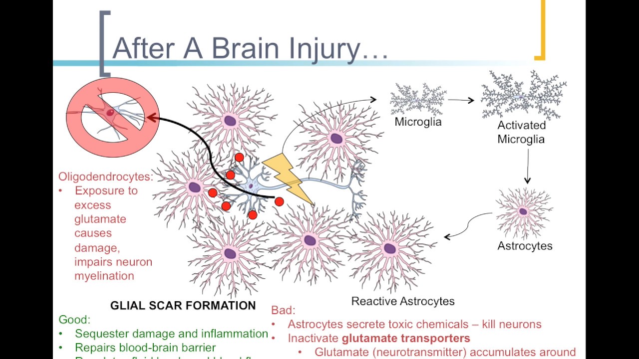 The Role of Glial Cell in Brain Injury and Disease - YouTube
