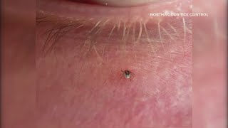 Tiny ticks that may carry tickborne diseases are out for the summer