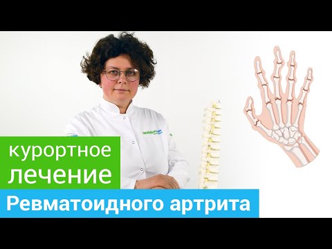 Где и как лечить РЕВМАТОИДНЫЙ АРТРИТ. Методы санаторного лечения РЕВМАТОИДНОГО АРТРИТА