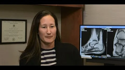 HSS Minute: Total Ankle Replacement