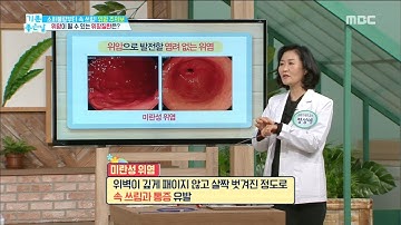 [HEALTHY] Are there any stomach diseases that can cause gastric cancer? ,기분 좋은 날20181130