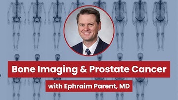 How Bone Scans Help Treat Prostate Cancer