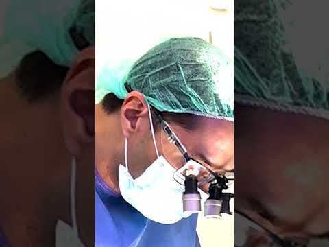 Implantes dentales navegados dinámicamente en Burgos Dr. Joel Joshi Otero  #burgos