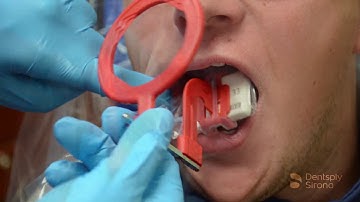 RINN XCP Short Arm Bitewing Placement | Dentsply Sirona