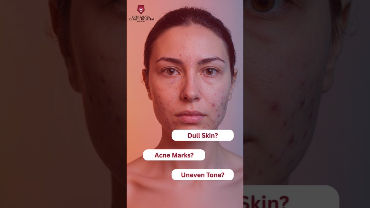 Tired of Dull Skin? Discover the Magic of Chemical Peels!