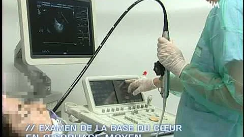 Qu'est-ce que l'examen ETO ?