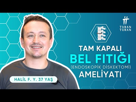 TAM KAPALI Bel Fıtığı Ameliyatı (Endoskopik Diskektomi) Sonrası: Halil Bey'in Hikayesi (2024)