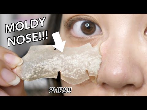 congested-overnight-blackhead-strip!-my-pores-shrunk-dude!